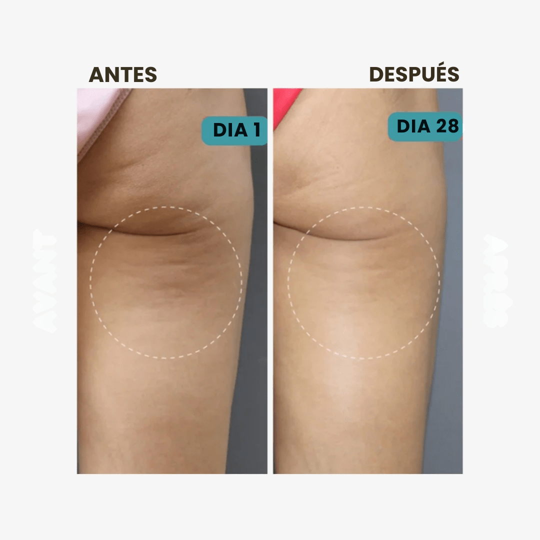 CelluFit™ – Compre 1 y llévese 2 - Calza Anticelulitis Reductoras