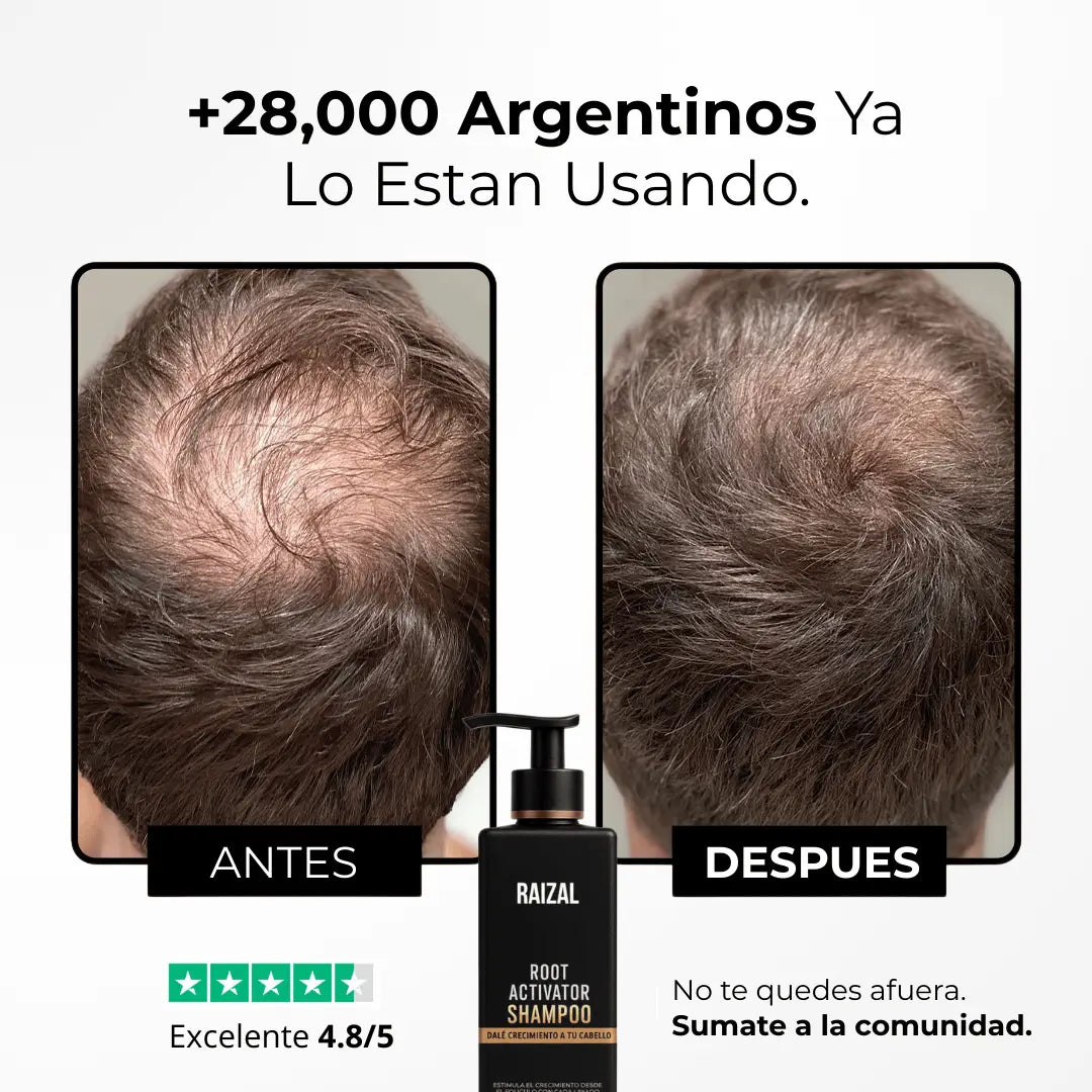 RAIZAL™ - Champú activador del adelgazamiento del cabello